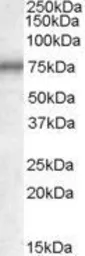 Anti-MEPCE antibody, Internal used in Western Blot (WB). GTX88595