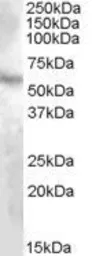 Anti-DMP1 antibody, Internal used in Western Blot (WB). GTX88597