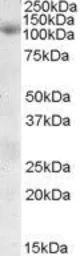 Anti-SNX19 antibody, Internal used in Western Blot (WB). GTX88598