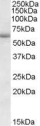 Anti-CDH23 antibody, Internal used in Western Blot (WB). GTX88601