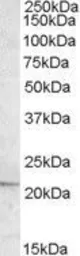 Anti-APOBEC3C antibody, C-term used in Western Blot (WB). GTX88604