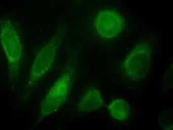 Anti-ODZ3 antibody, Internal used in Immunocytochemistry/ Immunofluorescence (ICC/IF). GTX88606