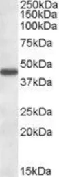 Anti-Aminoadipate aminotransferase antibody, Internal used in Western Blot (WB). GTX88607
