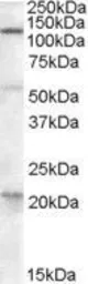 Anti-DAGLA antibody, C-term used in Western Blot (WB). GTX88615