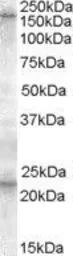 Anti-SUR1 antibody, C-term used in Western Blot (WB). GTX88616