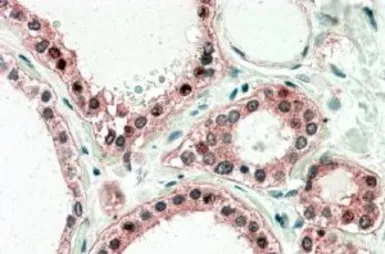 Anti-UXT antibody, C-term used in IHC (Paraffin sections) (IHC-P). GTX88619