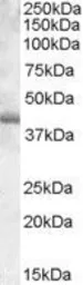 Anti-PU.1 antibody, Internal used in Western Blot (WB). GTX88620