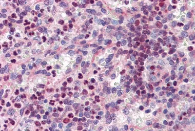 Anti-PU.1 antibody, Internal used in IHC (Paraffin sections) (IHC-P). GTX88620