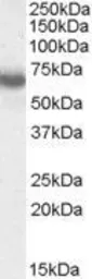 Anti-Ikaros antibody, Internal used in Western Blot (WB). GTX88621
