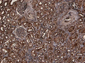 Anti-TMPRSS2 antibody, Internal used in IHC (Paraffin sections) (IHC-P). GTX88625