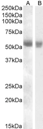 Anti-TMPRSS2 antibody, Internal used in Western Blot (WB). GTX88625