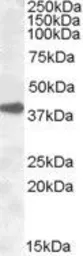 Anti-ERCC1 antibody, N-term used in Western Blot (WB). GTX88627