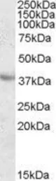 Anti-Apolipoprotein A5 antibody, C-term used in Western Blot (WB). GTX88628