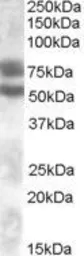 Anti-DACH1 antibody, Internal used in Western Blot (WB). GTX88629
