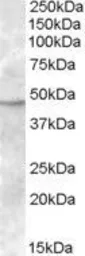 Anti-TMPRSS4 antibody, Internal used in Western Blot (WB). GTX88636