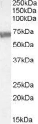Anti-ABCD4 antibody, Internal used in Western Blot (WB). GTX88637