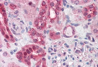 Anti-ABCD4 antibody, Internal used in IHC (Paraffin sections) (IHC-P). GTX88637