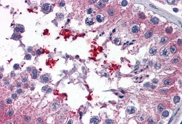 Anti-ABCD4 antibody, Internal used in IHC (Paraffin sections) (IHC-P). GTX88637
