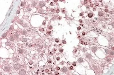 Anti-USP28 antibody, Internal used in IHC (Paraffin sections) (IHC-P). GTX88638