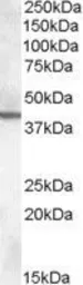Anti-ABHD12 antibody, C-term used in Western Blot (WB). GTX88640