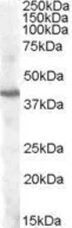 Anti-PITX3 antibody, Internal used in Western Blot (WB). GTX88644