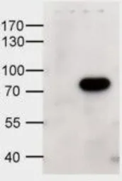 Anti-ABCD1 antibody, Internal used in Western Blot (WB). GTX88645