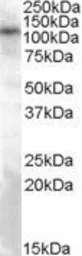 Anti-TRPC4 antibody, Internal used in Western Blot (WB). GTX88652