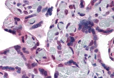 Anti-TRPC4 antibody, Internal used in IHC (Paraffin sections) (IHC-P). GTX88652