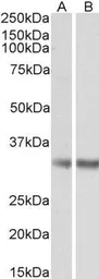 Anti-Monoglyceride lipase antibody, Internal (near N-term) used in Western Blot (WB). GTX88653