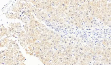 Anti-Monoglyceride lipase antibody, Internal (near N-term) used in IHC (Paraffin sections) (IHC-P). GTX88653