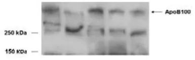 Anti-Apolipoprotein B antibody, Internal used in Western Blot (WB). GTX88654