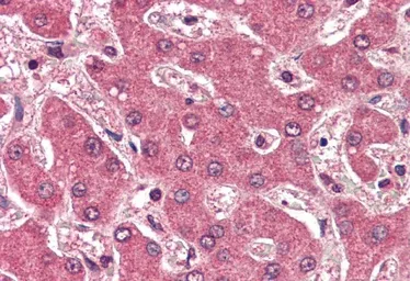 Anti-Apolipoprotein B antibody, Internal used in IHC (Paraffin sections) (IHC-P). GTX88654