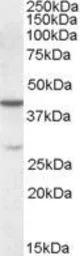 Anti-CBX8 antibody, Internal used in Western Blot (WB). GTX88655