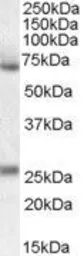 Anti-Alpha 2 Antiplasmin antibody, Internal used in Western Blot (WB). GTX88657