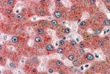 Anti-Alpha 2 Antiplasmin antibody, Internal used in IHC (Paraffin sections) (IHC-P). GTX88657