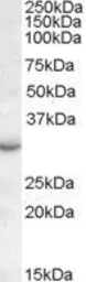 Anti-RAB23 antibody, C-term used in Western Blot (WB). GTX88658