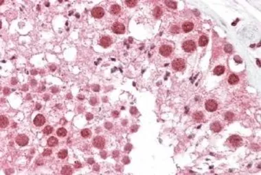 Anti-MSH5 antibody, Internal used in IHC (Paraffin sections) (IHC-P). GTX88660