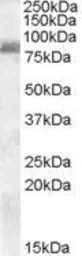 Anti-ZRANB1 antibody, C-term used in Western Blot (WB). GTX88665