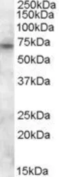 Anti-PMP70 antibody, Internal used in Western Blot (WB). GTX88667