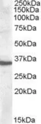 Anti-Apolipoprotein F antibody, C-term used in Western Blot (WB). GTX88675