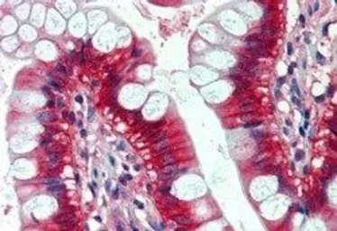 Anti-N-RAS antibody used in IHC (Paraffin sections) (IHC-P). GTX88676