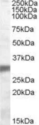 Anti-PHD3 antibody, Internal used in Western Blot (WB). GTX88678