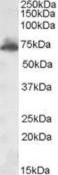 Anti-AKAP10 antibody, Internal used in Western Blot (WB). GTX88680