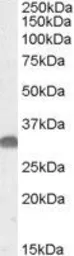 Anti-OTUB1 antibody, Internal used in Western Blot (WB). GTX88681
