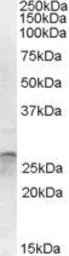 Anti-OTUB2 antibody, Internal used in Western Blot (WB). GTX88682
