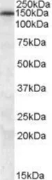 Anti-MRP5 antibody, N-term used in Western Blot (WB). GTX88691
