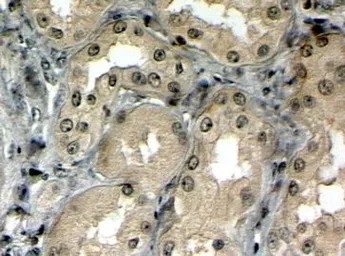 Anti-MRP5 antibody, N-term used in IHC (Paraffin sections) (IHC-P). GTX88691