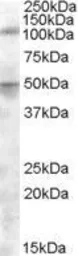 Anti-ERAP2 antibody, Internal used in Western Blot (WB). GTX88698