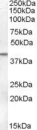 Anti-SERPINB6 antibody, Internal used in Western Blot (WB). GTX88711