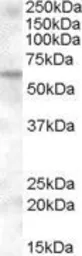 Anti-KPNA6 antibody, Internal used in Western Blot (WB). GTX88712